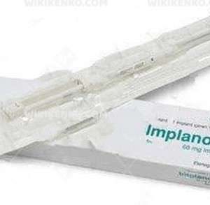 Nexplanon Implant
