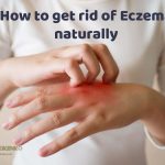 How to get rid of Eczema naturally