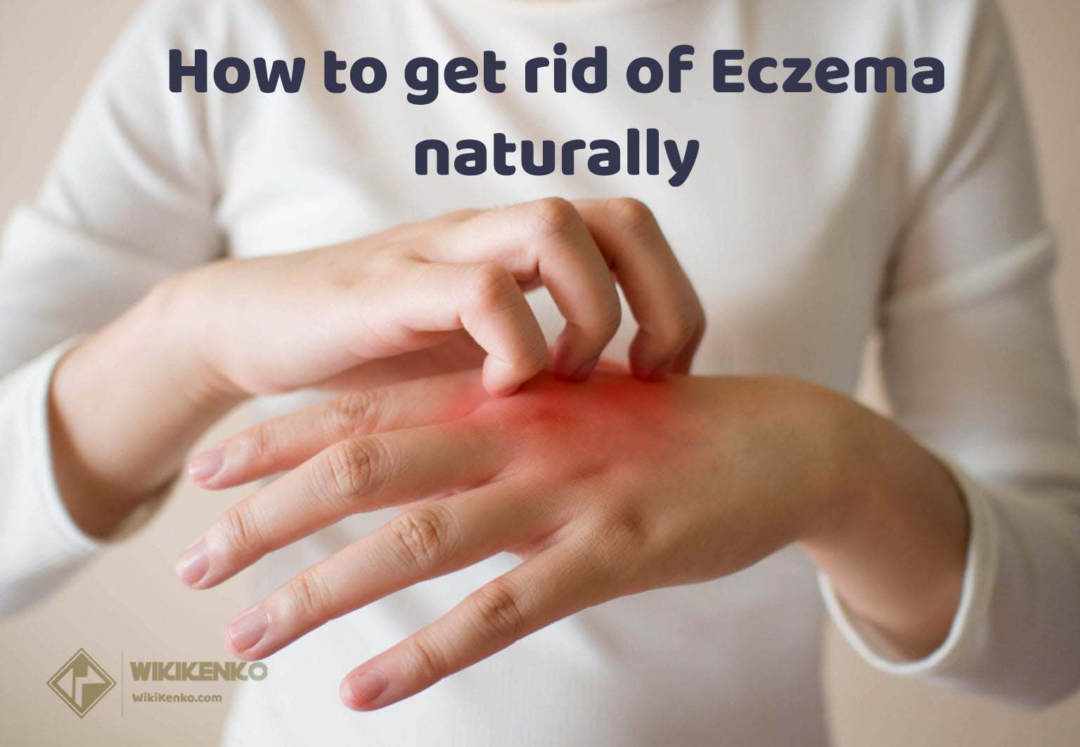 Read more about the article How to get rid of Eczema naturally