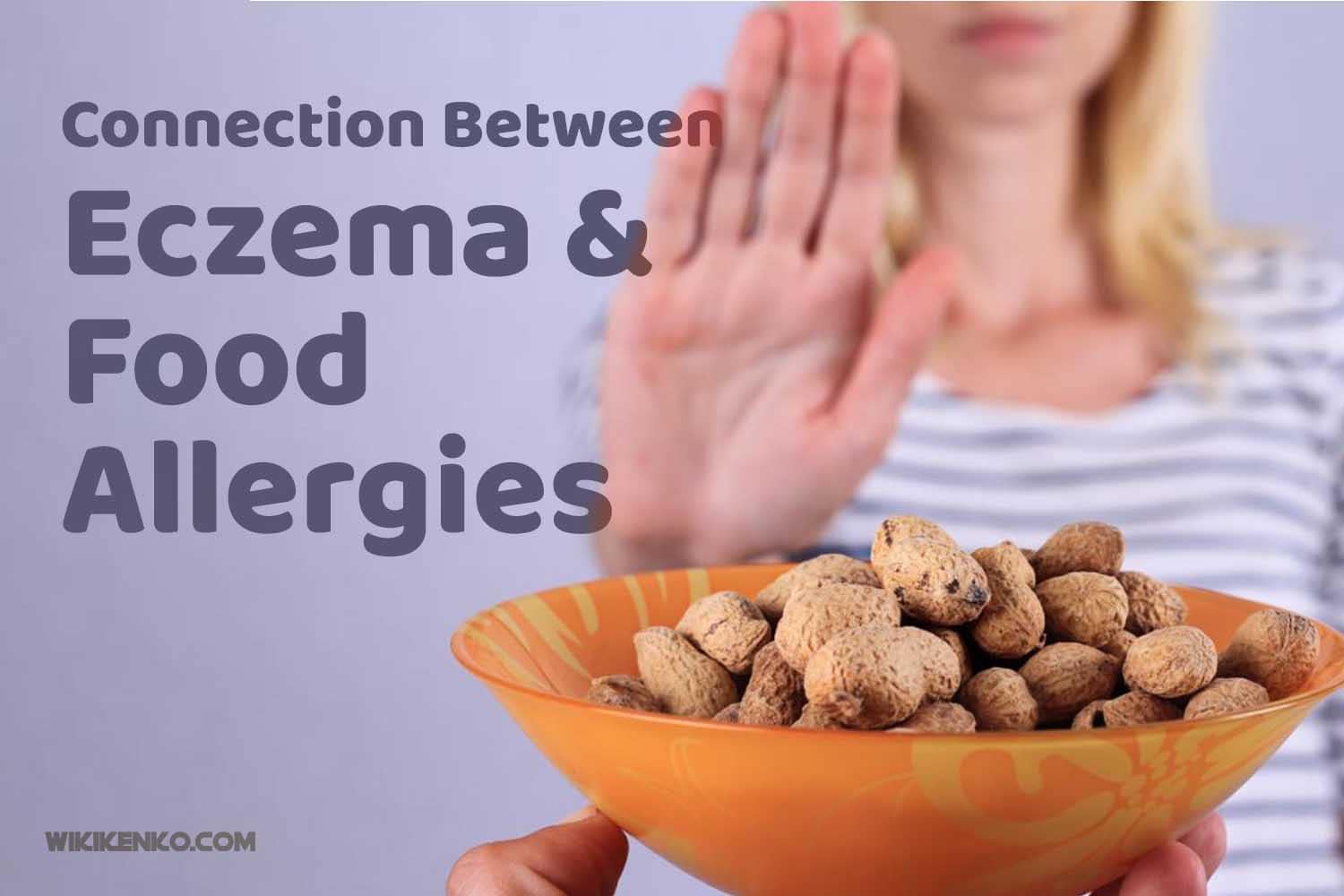 Read more about the article Connection Between Eczema and Food Allergies