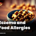 Connection Between Eczema and Food Allergies