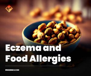 Connection Between Eczema and Food Allergies