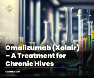 Omalizumab (Xolair) – A Treatment for Chronic Hives