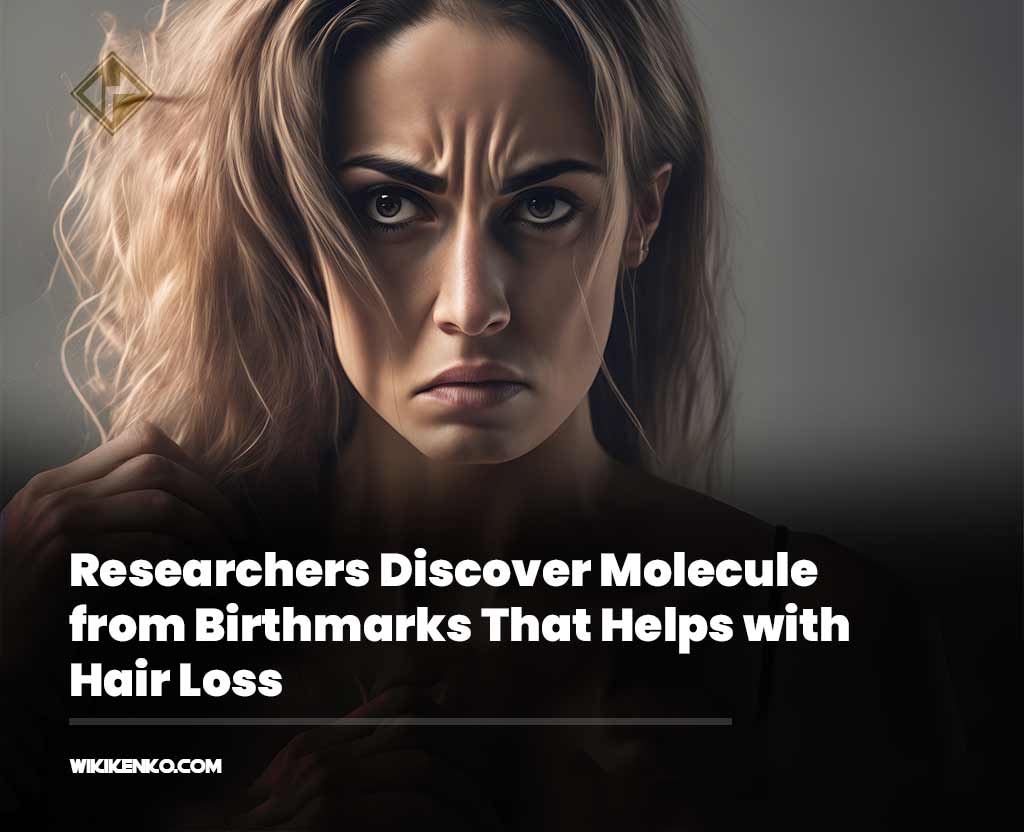 You are currently viewing Researchers Discover Molecule from Birthmarks That Helps with Hair Loss—Could a New Injection Hit the Market?