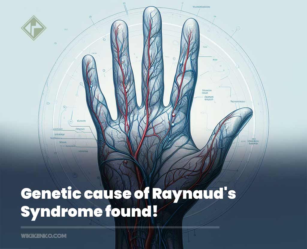 You are currently viewing Genetic cause of Raynaud’s Syndrome found!